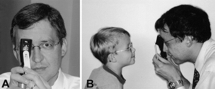 Retinoscope Design 1 Retinoscope Design 1